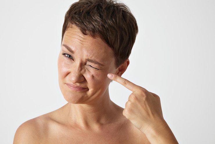 Cara Mengetahui Skin Barrier Rusak, Waspadai 6 Hal Ini yang Sering Kamu Alami!