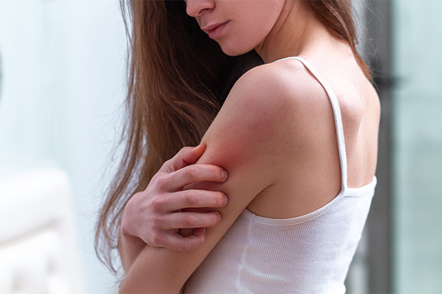 Body Wash untuk Pemilik Kulit Eczema yang Tepat, Jangan Asal Beli!