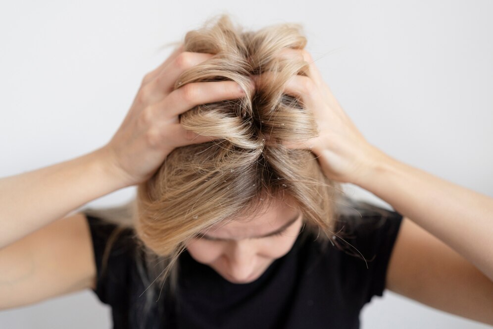Kenapa Rambut Susah Diatur dan Disisir? Ini Jawaban + Tips Mengatasinya!