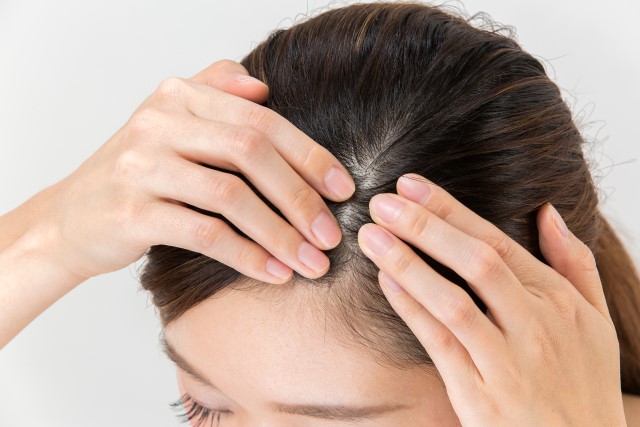 4 Cara Perawatan Kulit Kepala dan Rambut Agar Lebih Sehat dan Berkilau