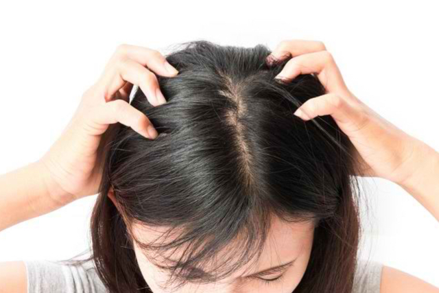 Tips untuk Kulit Kepala Sehat: Kunci Menuju Rambut yang Indah dan Berkilau