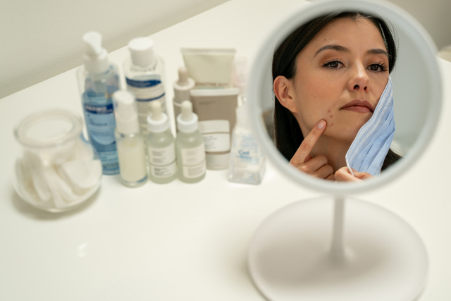 5 Kandungan Skincare yang Cocok untuk Kulit Berjerawat