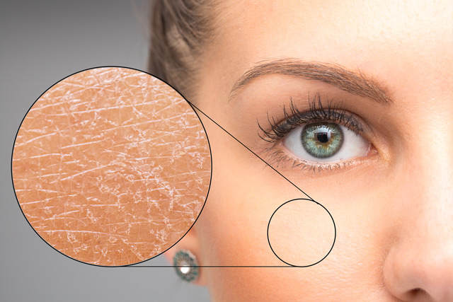 6 Kandungan Skincare untuk Kulit Kering yang Ampuh Merawat Skin Barrier dan Bikin Glowing