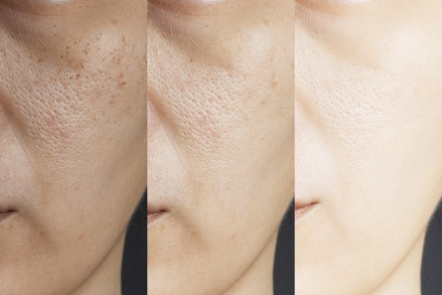 7 Kandungan Skincare untuk Mencerahkan Wajah