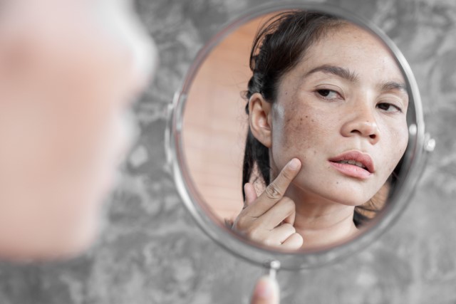 7 Skincare untuk Menghilangkan Bekas Jerawat dan Bruntusan Terbaik