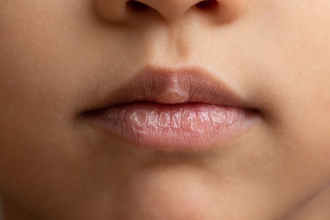 Urutan Step Lip Product untuk Atasai Bibir Kering, Jangan Sampai Salah!