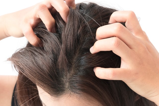 Faktor Kenapa Rambut Gatal Padahal Tidak Ada Kutu dan Ketombe